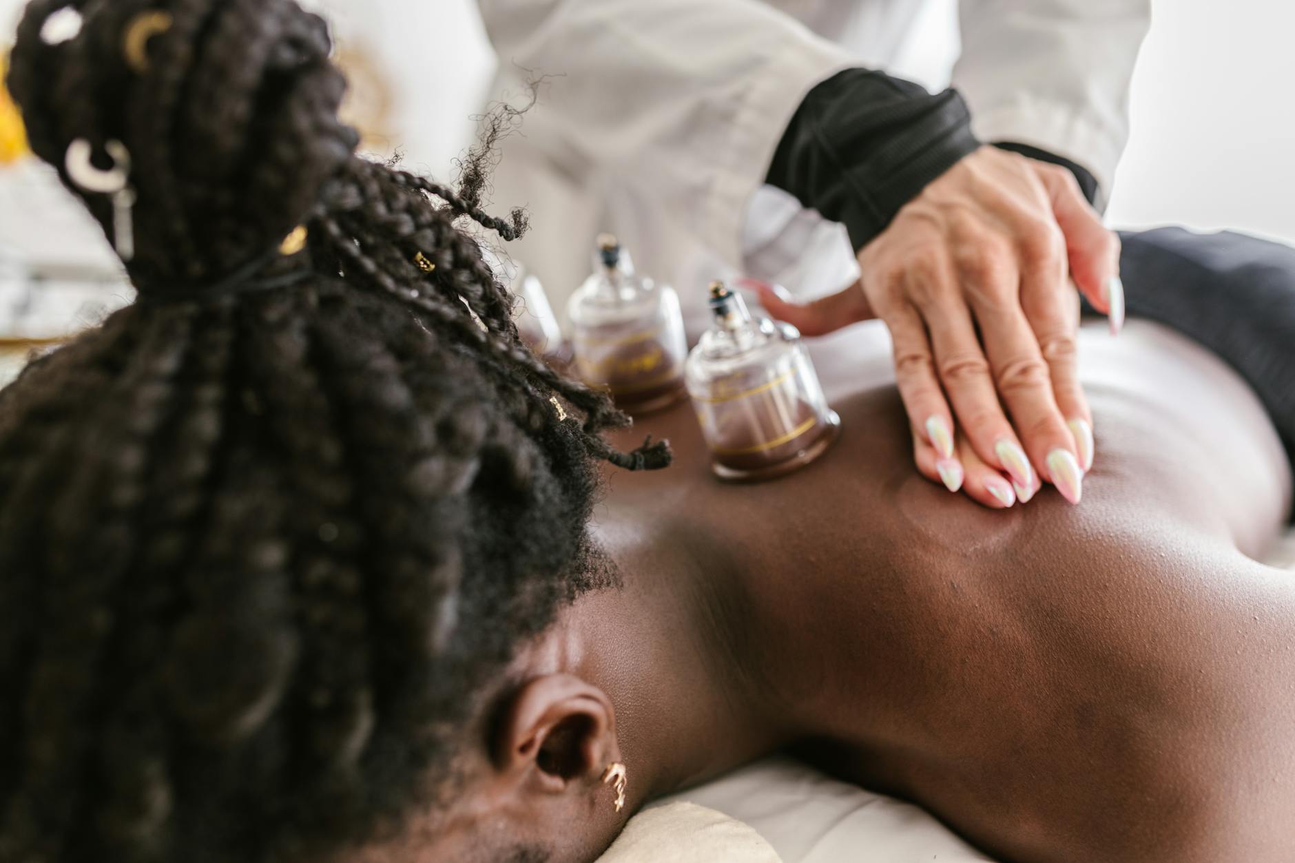 Cupping therapy treatment